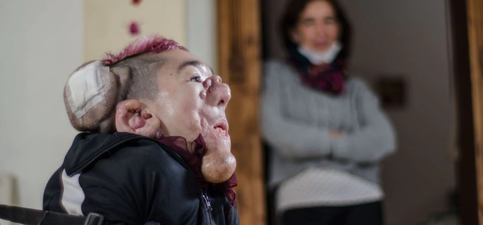 Matías Fernández Burzaco